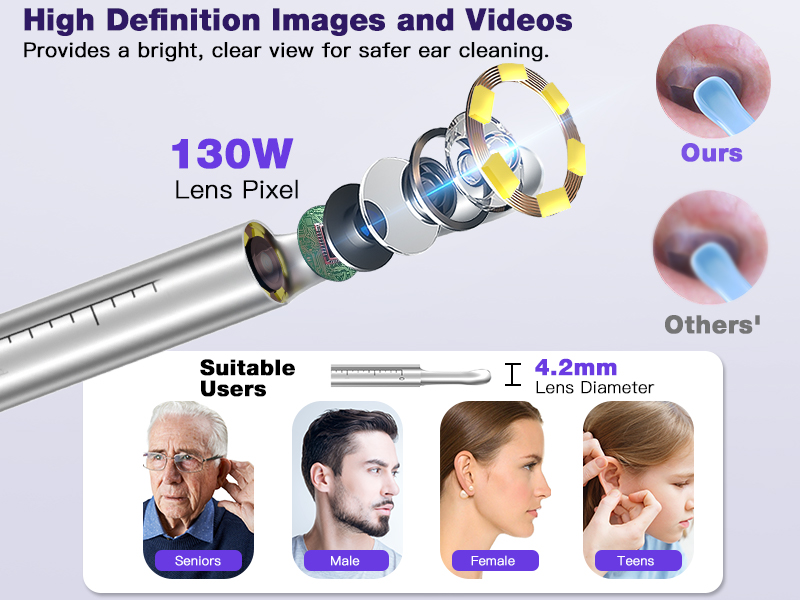 Cross-Border New Version Smart Visual Ear Spoon - 1920P HD Direct Connection, Ear Cleaning & Care Kit